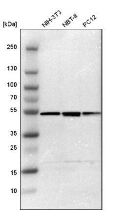 Tbp7 Antibody, Novus Biologicals 0.1mL; Unlabeled:Antibodies, Polyclonal